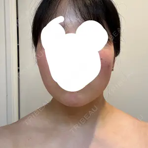 TCB東京中央美容外科 TCB東京中央美容外科 なんば院口コミ