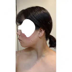 TCB東京中央美容外科 TCB東京中央美容外科 なんば院口コミ