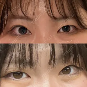 口コミ