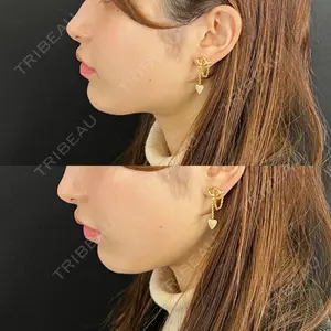 藤・ナチュレ美容クリニック 銀座院の