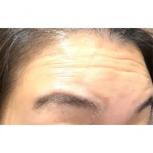 Re:anne clinic 銀座 【リアンクリニック銀座】口コミ