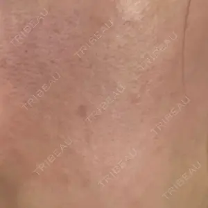 心斎橋KT美容クリニック口コミ