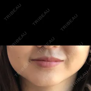 DMTC美容皮膚科 DMTC美容皮膚科 日本橋院口コミ