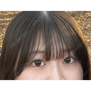 TCB東京中央美容外科 TCB東京中央美容外科 大宮西口院口コミ