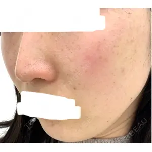 アモーレクリニック アモーレクリニック 名古屋院口コミ