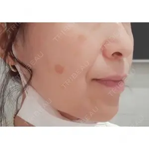 APスキンクリニック銀座口コミ