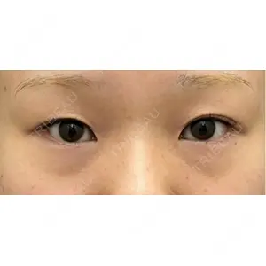 口コミ