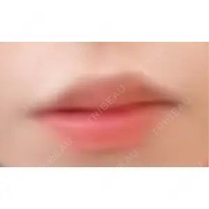 アネシス美容クリニック口コミ