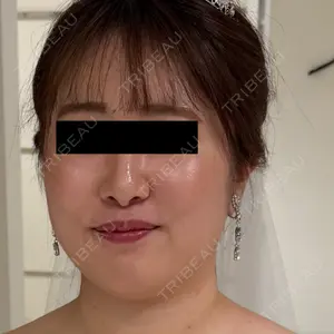 東京シンデレラ美容外科 東京シンデレラ美容外科 池袋院口コミ