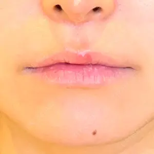 LOUIS CLINIC 二子玉川院【ルイクリニック】口コミ
