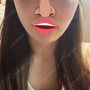 口コミ
