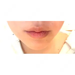 メディカルアルファクリニック口コミ
