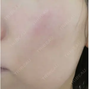 ルラ美容クリニック ルラ美容クリニック 静岡院口コミ
