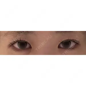 LUHO（ルホ）美容外科口コミ