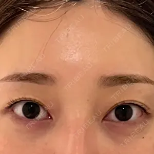 水の森美容クリニックの口コミ