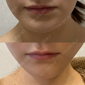 アリエル美容クリニック アリエル美容クリニック 横浜院口コミ