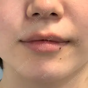 口コミ