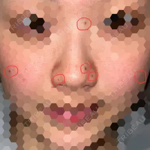 口コミ