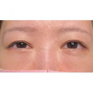 HAAB×DREAM BEAUTY CLINIC HAAB×DREAM BEAUTY CLINIC 大阪梅田院口コミ