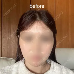セギム美容整形外科口コミ
