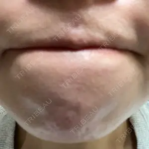 横浜皮膚科ゆうスキンクリニック 横浜院口コミ