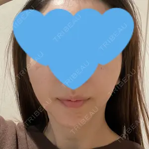 銀座マイアミ美容外科口コミ