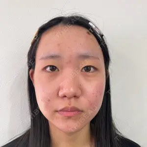 LUHO（ルホ）美容外科口コミ