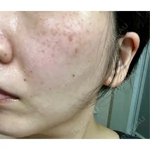 ルラ美容クリニック ルラ美容クリニック 大宮院口コミ