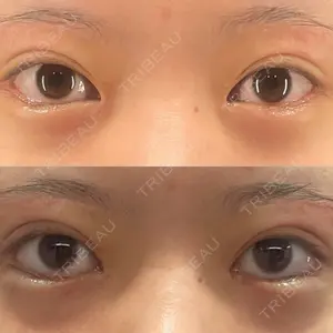 BIANCA CLINIC BIANCA銀座口コミ