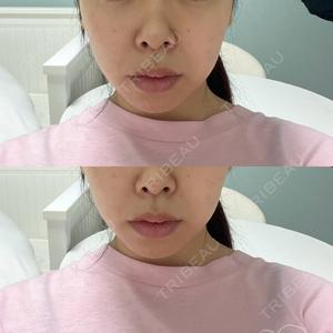 A CLINIC（エークリニック） A CLINIC（エークリニック） 池袋院口コミ