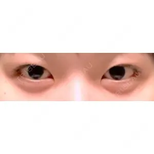 口コミ