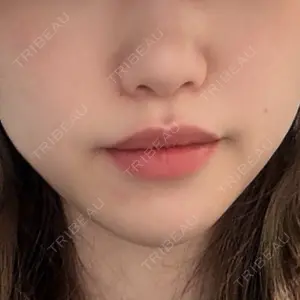 アリエル美容クリニック アリエル美容クリニック 大宮院口コミ