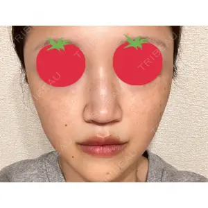APスキンクリニック銀座口コミ