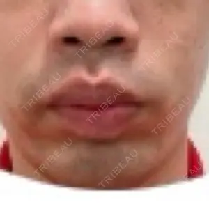口コミ