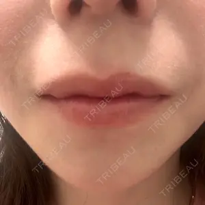 ルラ美容クリニック ルラ美容クリニック 名古屋栄院口コミ
