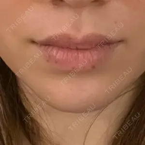 Wクリニック Wクリニック 梅田院口コミ