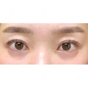 プロミス整形外科口コミ