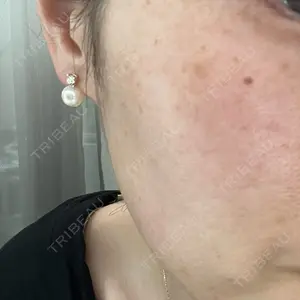 GLAMRULE CLINIC (グラムルール クリニック) 銀座院口コミ