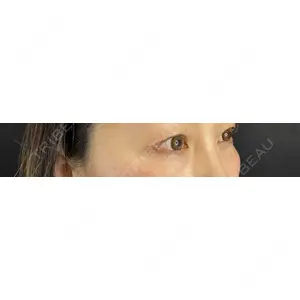 藤・ナチュレ美容クリニック 藤・ナチュレ美容クリニック 銀座院口コミ