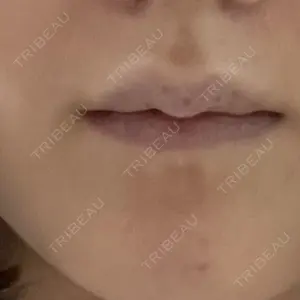 フォンタナクリニック天神口コミ