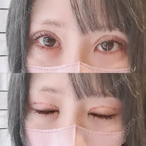 口コミ