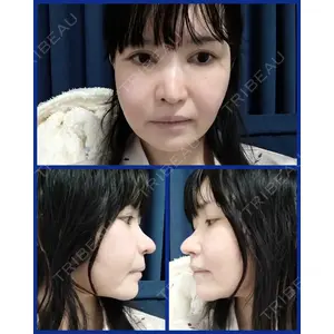 リッツ美容外科の口コミ