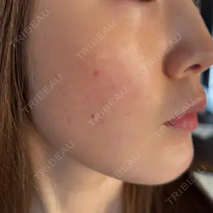 ルラ美容クリニック ルラ美容クリニック 静岡院口コミ