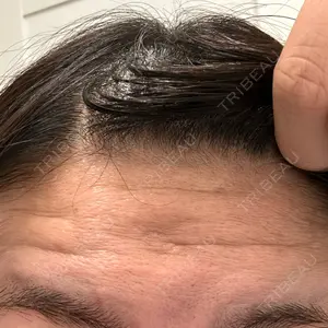 TCB東京中央美容外科 TCB東京中央美容外科 福岡天神院口コミ