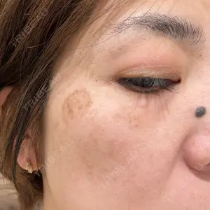 Fellez Clinic【フェルズクリニック】口コミ