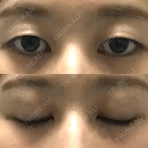 マーブル整形外科口コミ
