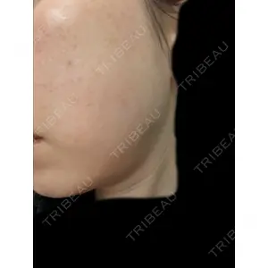 AZ BEAUTY CLINIC口コミ