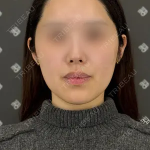 EMMO FACE CLINIC EMMO FACE CLINIC 大阪梅田院口コミ