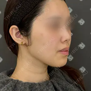 EMMO FACE CLINIC EMMO FACE CLINIC 大阪梅田院口コミ