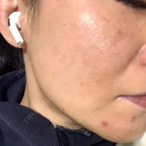 ルラ美容クリニック ルラ美容クリニック 福岡本院口コミ